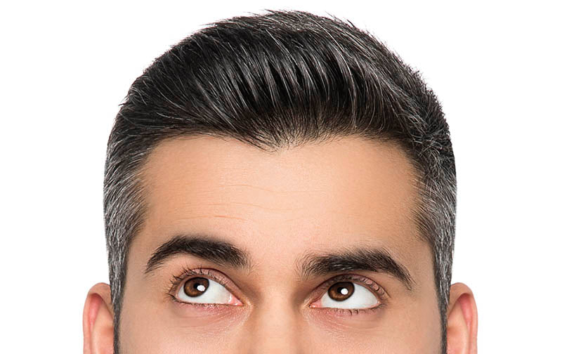 Causes of Hair Greying