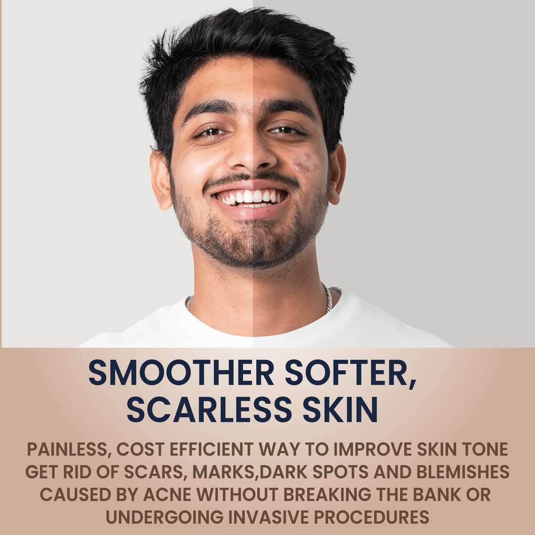 Skynoptik Anti Scar Gel
