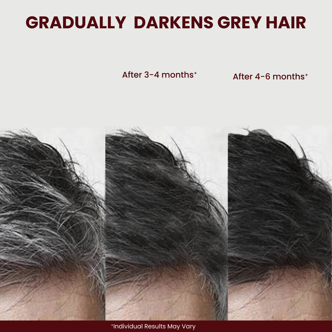 SkynOptik Slay Grey Hair Serum